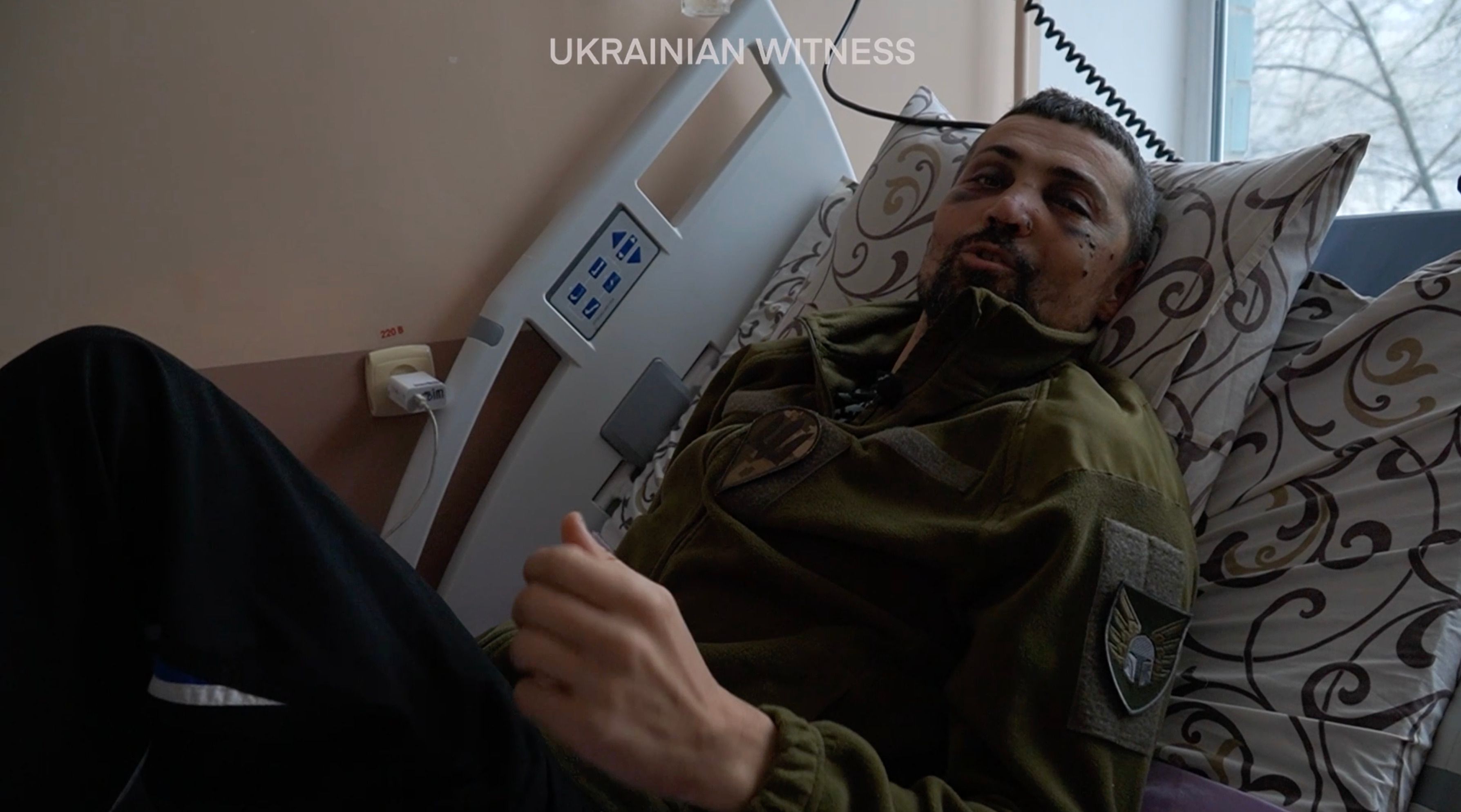 Актор Дмитро Лінартович отримав поранення у Соледарі – який стан зірки ТойХтоПройшовКрізьВогонь Актор Дмитро Лінартович отримав поранення у Соледарі – який стан зірки ТойХтоПройшовКрізьВогонь