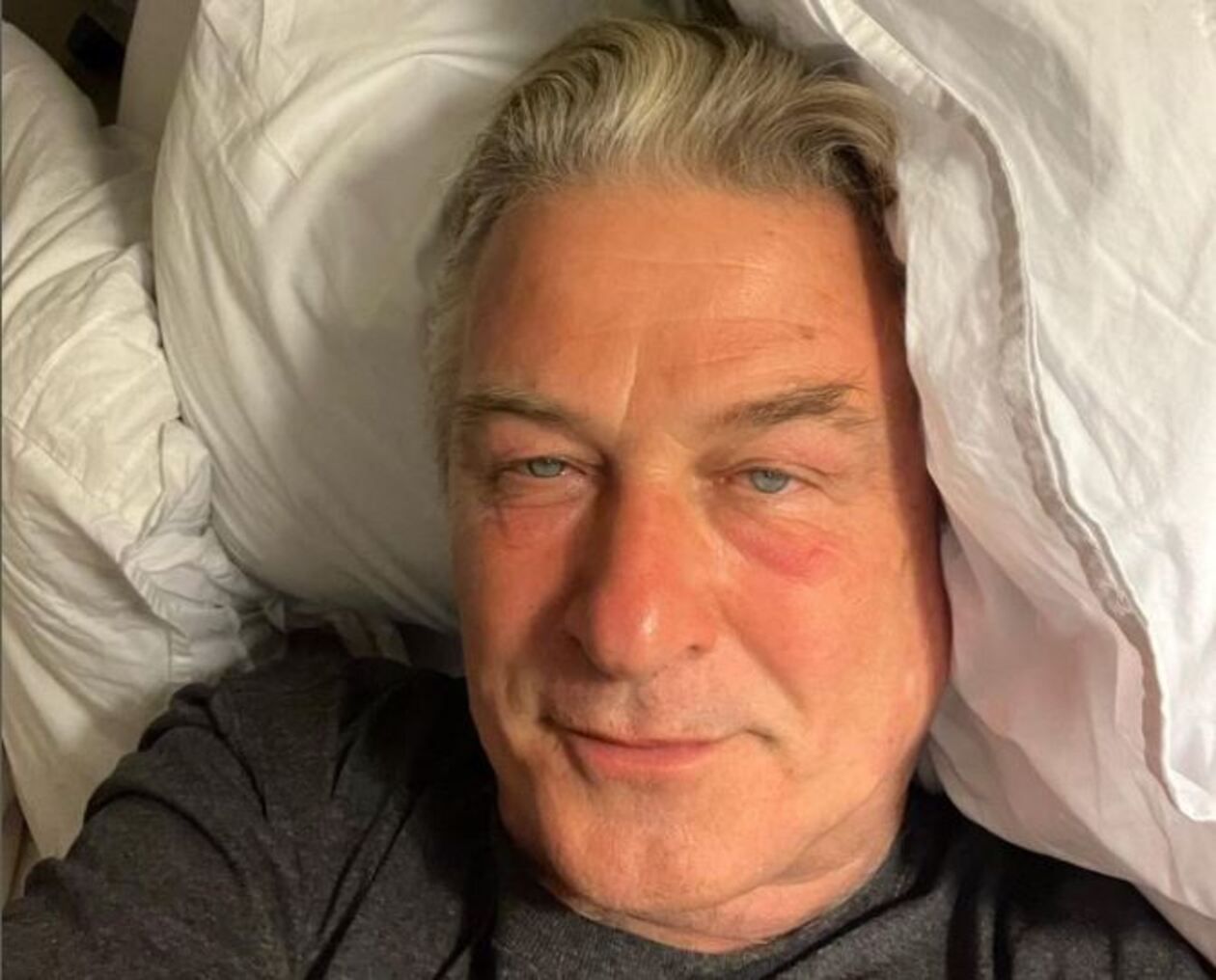 Алек Болдвин перенес операцию – состояние актера, его биография и личная жизнь Алек Болдвин перенес операцию – состояние актера, его биография и личная жизнь