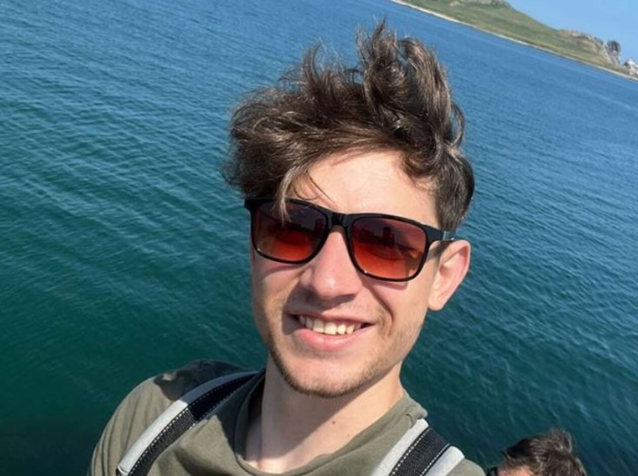 Александра Грекова, украинского актера, сильно избили в Дублине – фото Александра Грекова, украинского актера, сильно избили в Дублине – фото