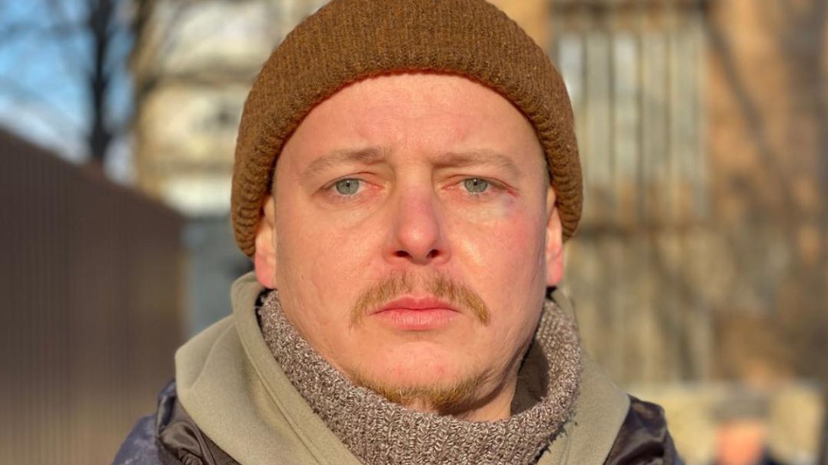 Актора Миколу Лемешка побили в Дніпрі – як він виглядає зараз, фото та деталі нападу 
