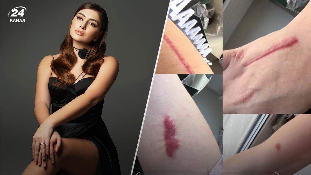 Катерина Тышкевич Катерина Тышкевич